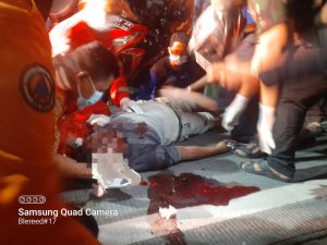 Jalan Kedung Cowek Kembali Menuai Korban Kecelakaan