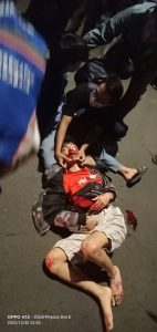 Gegara Ngebut Tak Terkendali, Nyungsep Cium Aspal