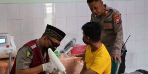 Layani Sepenuh Hati, Polres Nganjuk Gelar Program Operasi Hapus Tato Gratis