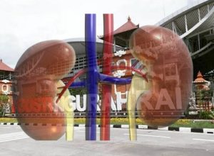 Polri Ungkap Oknum Imigrasi Beri Jalur Khusus Loloskan Pendonor Ginjal