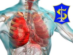 PEMKOT SURABAYA LAKUKAN SEJUMLAH LANGKAH ANTISIPASI CEGAH MUNCULNYA PNEUMONIA MISTERIUS
