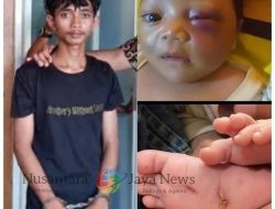 Emosi Tak Terkendali, Pemuda di Lombok Barat Aniaya Bayi Kandung Hingga Babak Belur