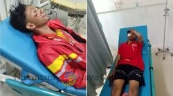 Luput Perhatian Dari Pemerintah, Jalan Rusak Bypass Cepu Kembali Makan Korban