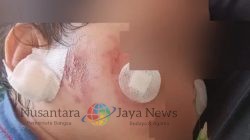 Kasus Balita Luka di Daycare Surabaya, DPRD Panggil Pengelola: Pemkot Tegaskan Izin Bisa Dicabut