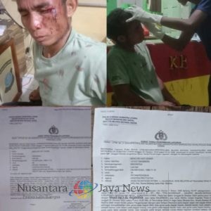 Polsek Muara Batang Gadis Malas Menjalankan Prosedur Hukum, Dua Kali Warga Teraniaya Melapor Tak Diproses