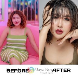 Operasi Kedua di Korea Selatan, Aprilia Sky Tampil Lebih Muda dan Percaya Diri