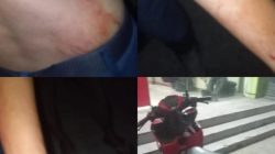 Driver Ojol Dibegal, Selamat Meski Alami Luka di Tangan dan Badan