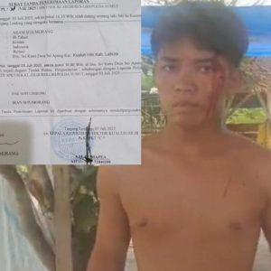 Keluarga Korban Penganiayaan Anak di Sungai Apung Kecewa Terdakwa Divonis Lepas oleh PN Rantauprapat