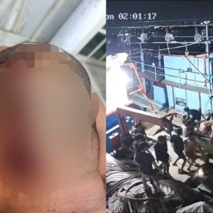 Diduga Diserang Puluhan Orang, Pemancing di Asahan Mengalami Luka Serius