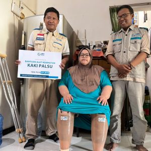 Tak Ingin Berhenti Melangkah, Rara dan Sudamaji Terima Bantuan Kaki Palsu